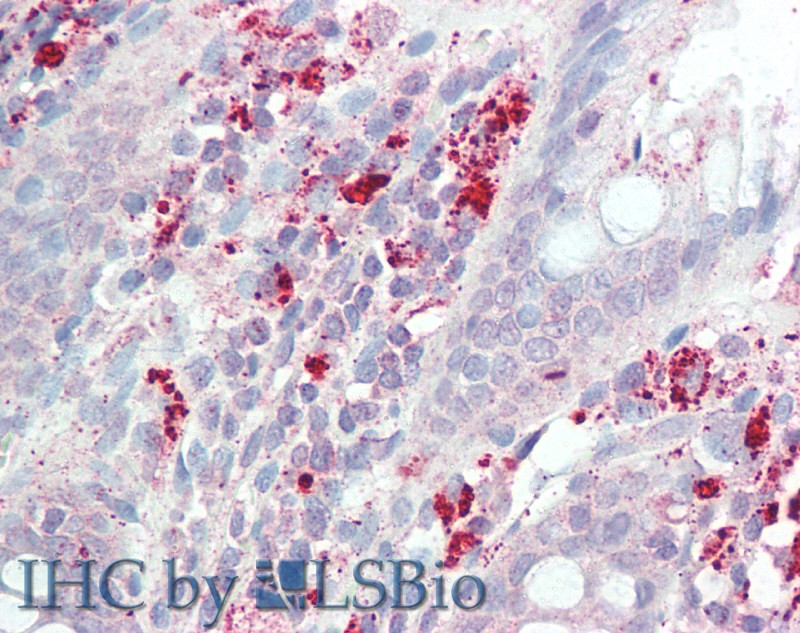 Goat Anti-IL3RA / CD123 Antibody