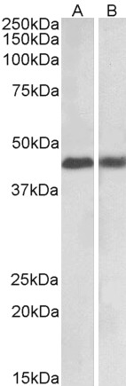 Goat Anti-IL6R / CD126 (aa249-263) Antibody