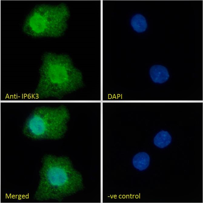 Goat Anti-IP6K3  Antibody