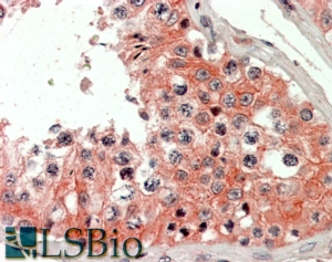 Goat Anti-IQGAP2 Antibody