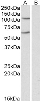 Goat Anti-IREB2 / IRP2 Antibody