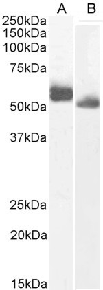 Goat Anti-IRF4 (aa393-407) Antibody
