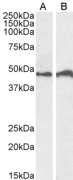 Goat Anti-IRF4 Antibody