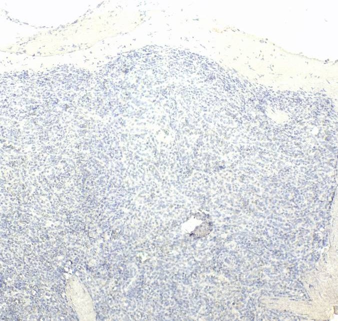 Goat Anti-IRF5 Antibody