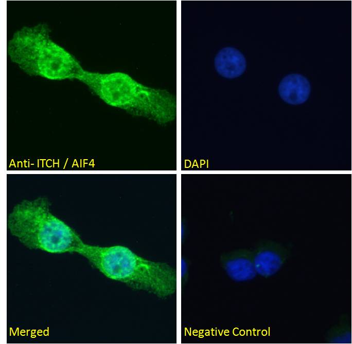 Goat Anti-ITCH / AIF4 Antibody