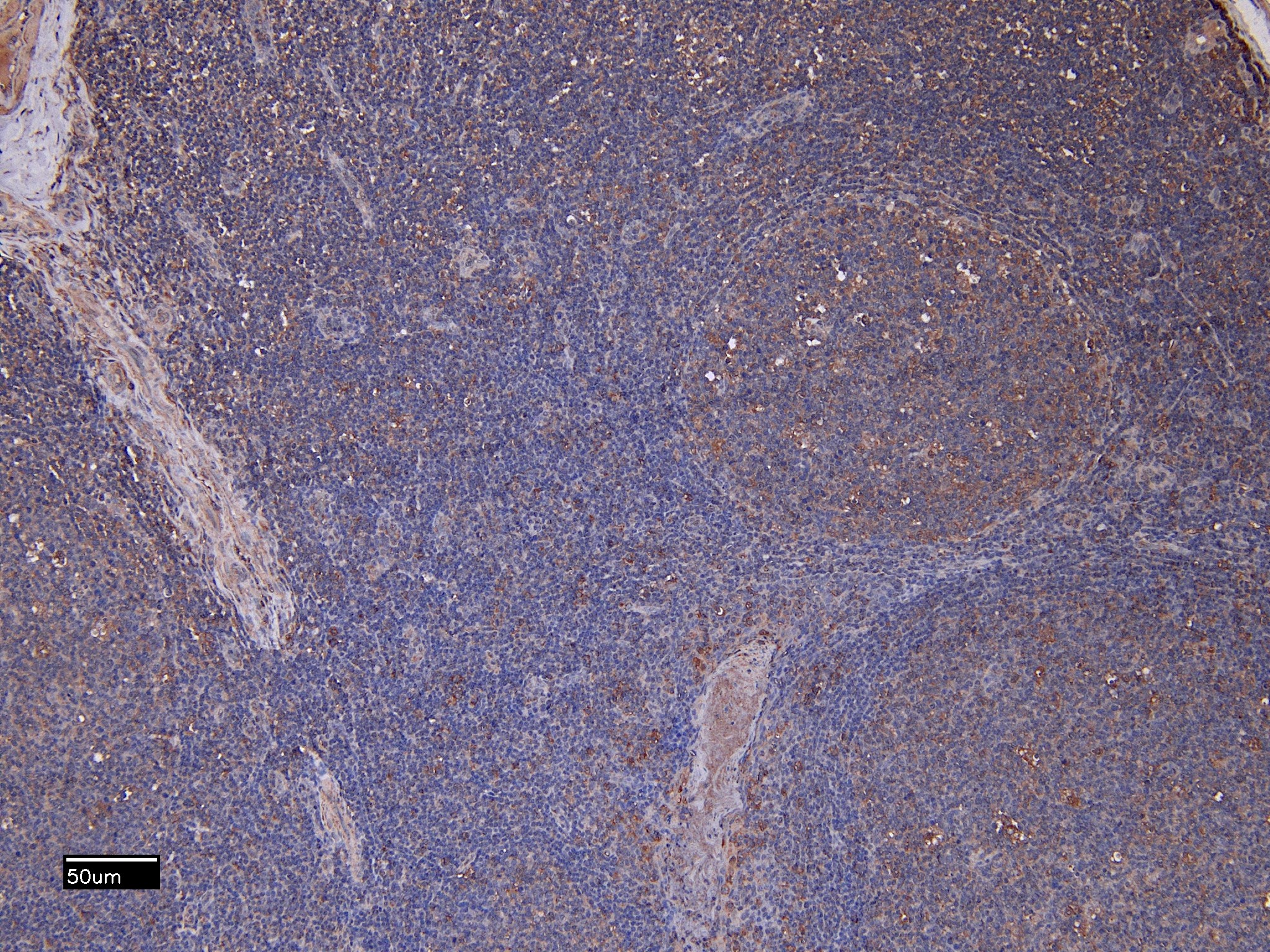 Goat Anti-ITGAM / CD11B Antibody