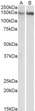 Goat Anti-ITGB1 / CD29 Antibody