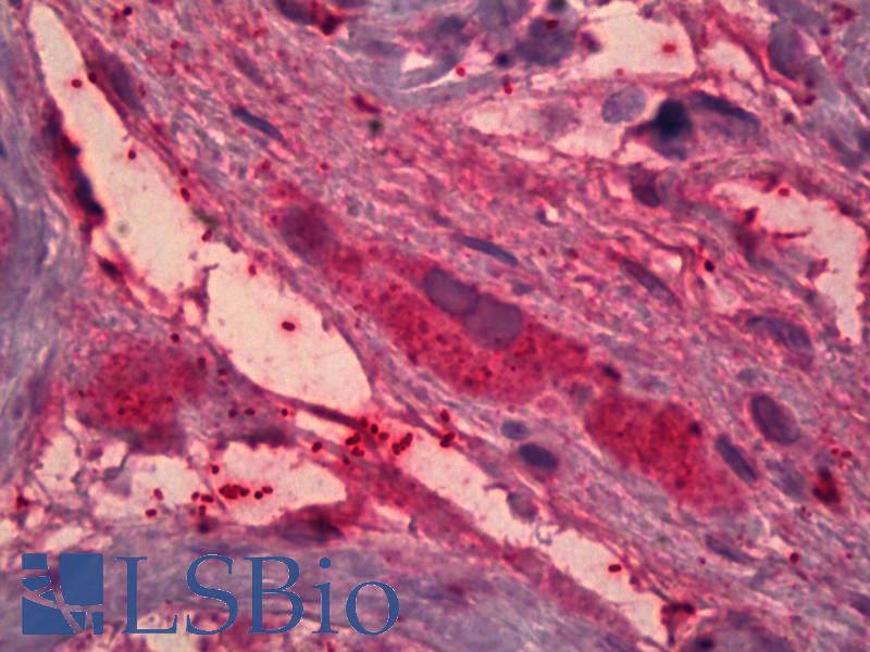 Goat Anti-ITIH4 (aa890-903) Antibody