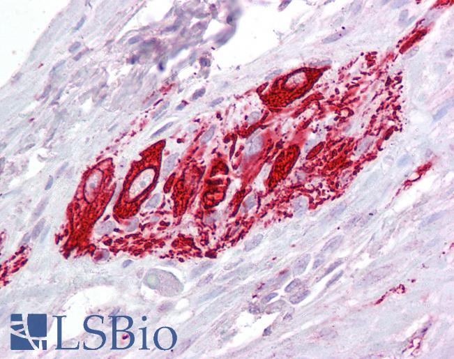 Goat Anti-ITM2B Antibody