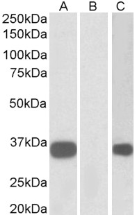 Goat Anti-KCNIP3 Antibody