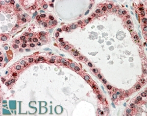 Goat Anti-KCNN2 Antibody