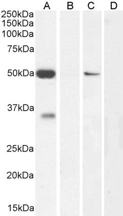 Goat Anti-KCNN4 / KCa3.1 Antibody