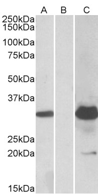 Goat Anti-KCTD11 Antibody