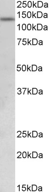 Goat Anti-KDM2A (aa445-459) Antibody