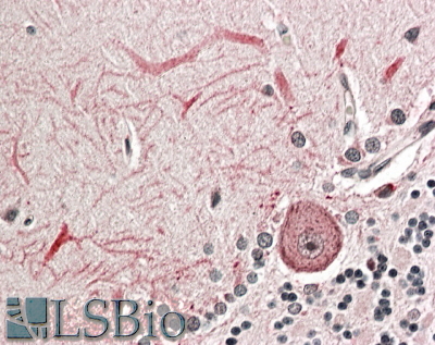 Goat Anti-KEAP1 (aa41-53) Antibody