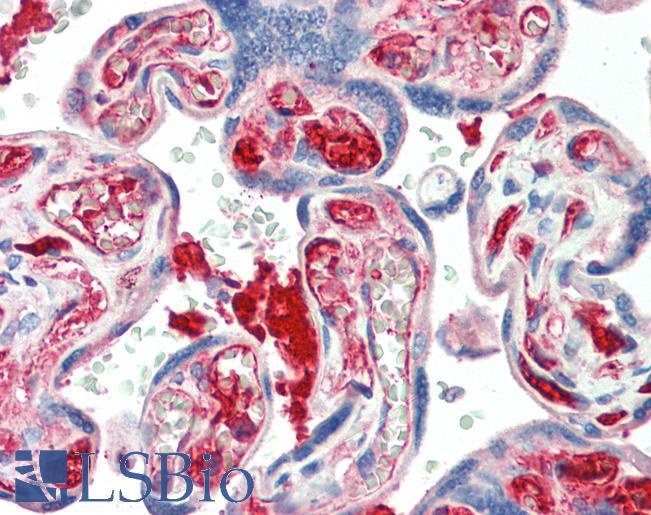 Goat Anti-KIAA0319 Antibody