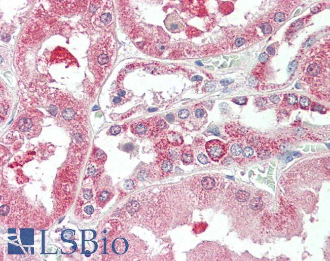 Goat Anti-KIF6 Antibody