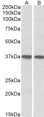 Goat Anti-KLF2 / LKLF Antibody