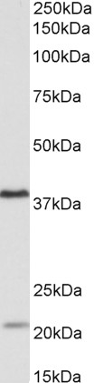 Goat Anti-KLHDC8B Antibody