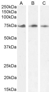 Goat Anti-KLHL6 / Kelch-like 6 Antibody