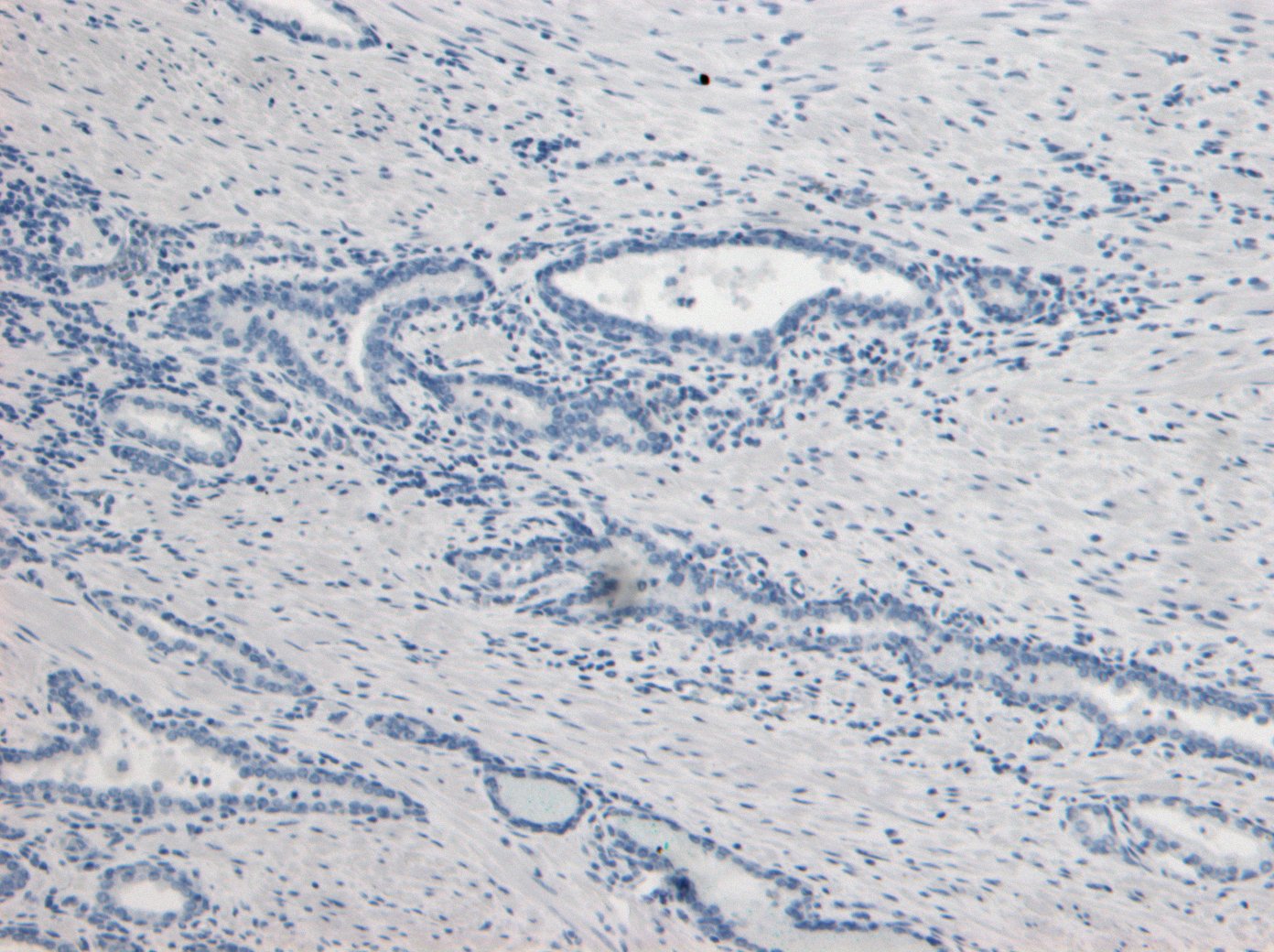 Goat Anti-KLK2 Antibody