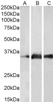 Goat Anti-KLK5 Antibody