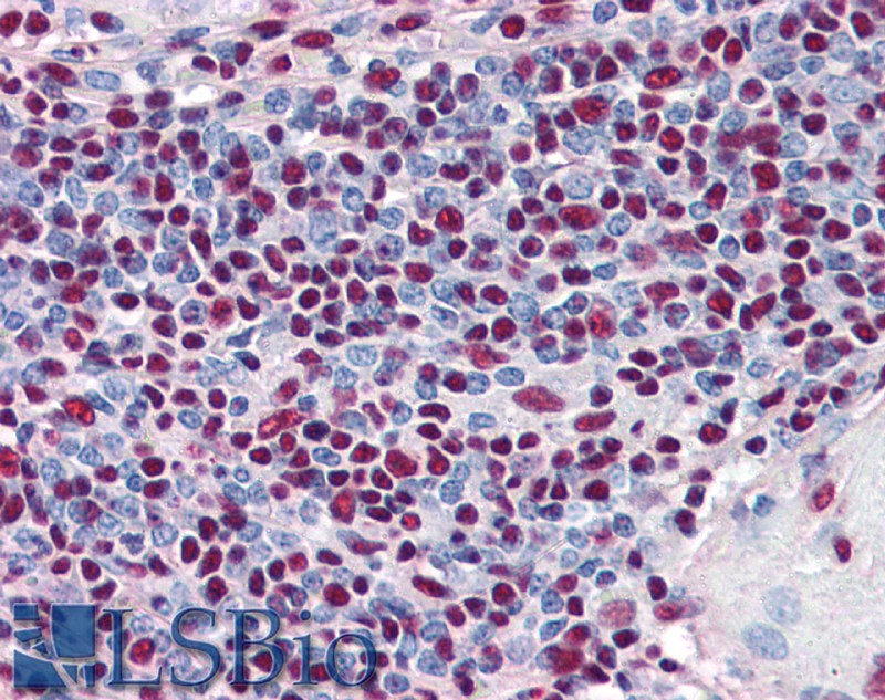 Goat Anti-Ku80 / XRCC5 Antibody