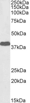 Goat Anti-Laforin (isoform a), Biotinylated Antibody