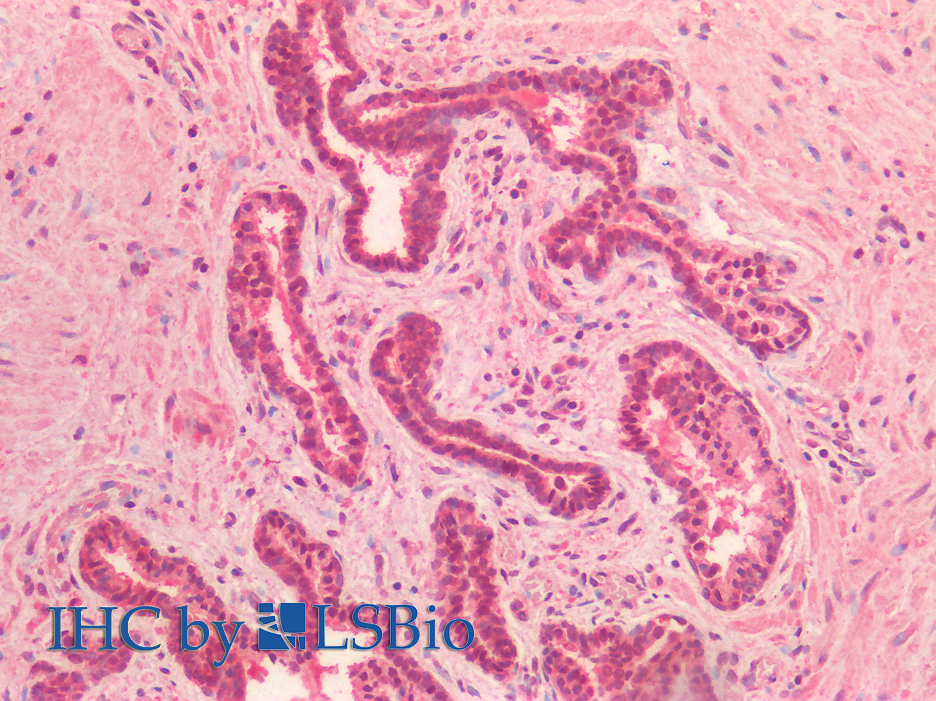 Goat Anti-Lamin A / Lamin A/C Antibody