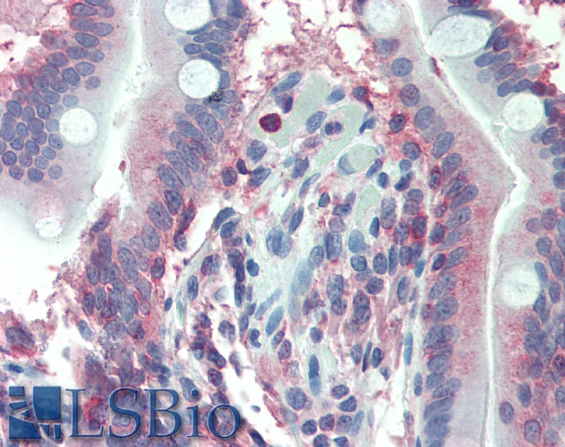 Goat Anti-LASP1 (internal region) Antibody