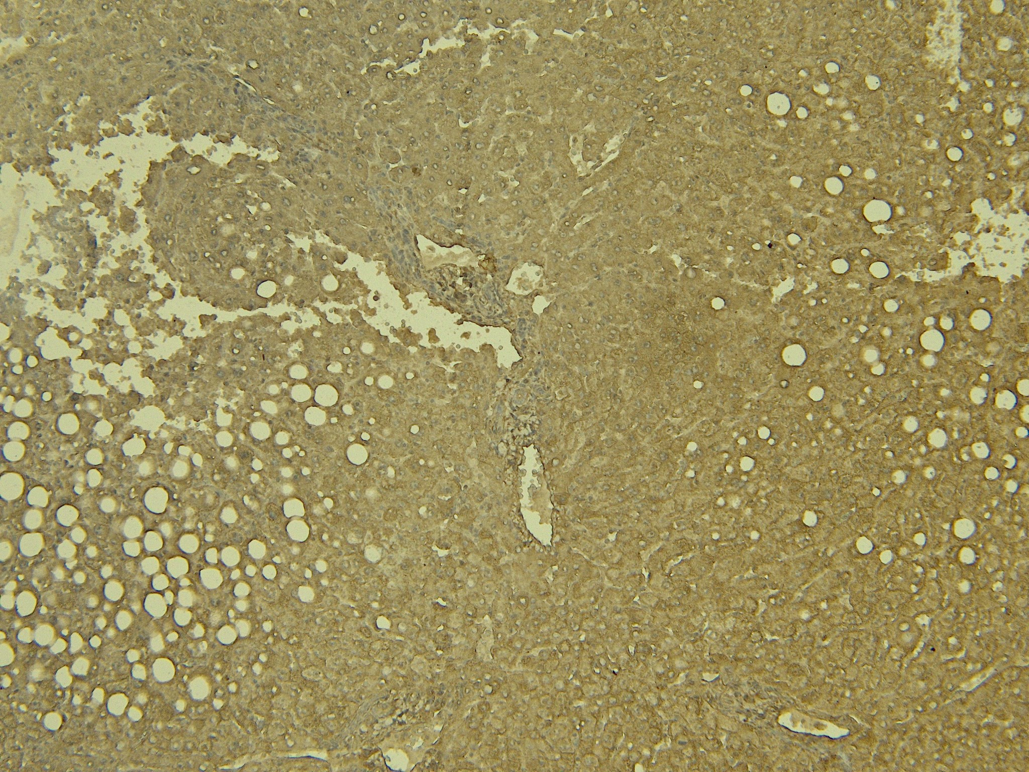Goat Anti-LCAT (aa366-378) Antibody
