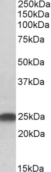 Goat Anti-LIN7B / MALS-2 Antibody