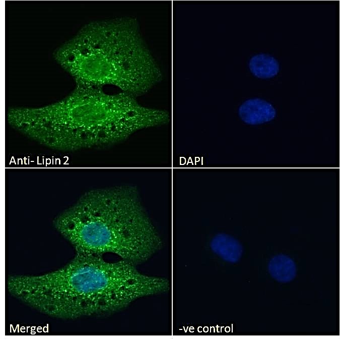 Goat Anti-Lipin 2 Antibody