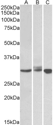 Goat Anti-LIVIN / BIRC7 Antibody