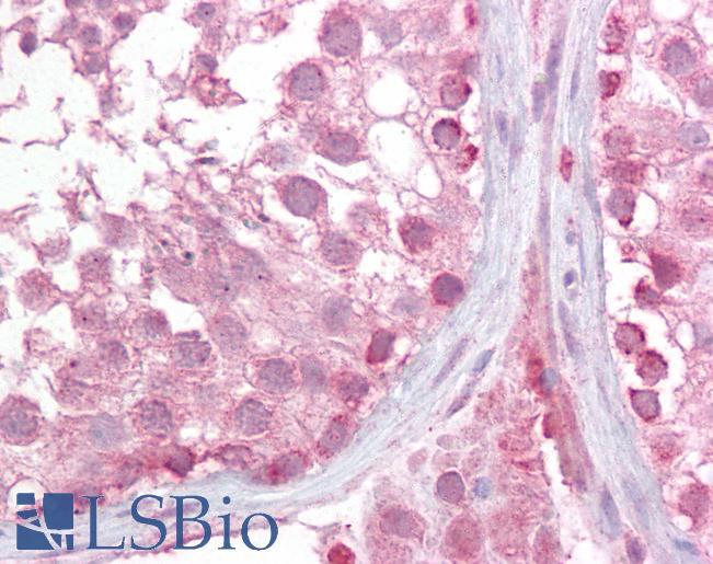 Goat Anti-LMX1B Antibody