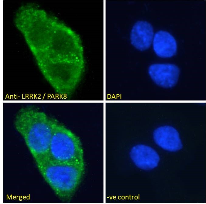 Goat Anti-LRRK2 / PARK8 (near C Terminus) Antibody