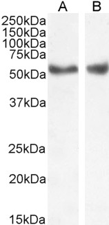 Goat Anti-LXR alpha / LXR beta Antibody