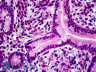 Goat Anti-LYP / PTPN22 Antibody