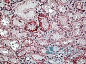 Goat Anti-Lysosomal hyaluronidase Antibody
