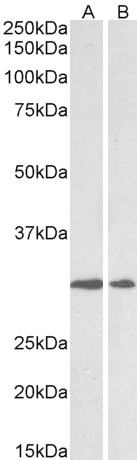 Goat Anti-lysyl oxidase Antibody