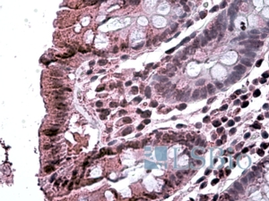 Goat Anti-MAP3K7IP2 Antibody