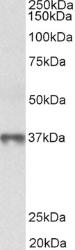 Goat Anti-MAT2B (isoform 1) Antibody