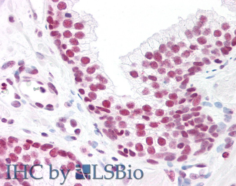 Goat Anti-MAX Antibody