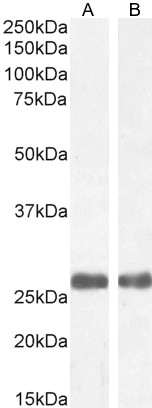 Goat Anti-MBL2 / Mannan-Binding Lectin Antibody