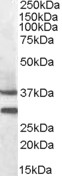Goat Anti-MC5R Antibody