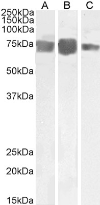 Goat Anti-MCAM / CD146/ MUC18 Antibody