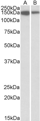 Goat Anti-MCF2L Antibody