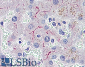 Goat Anti-MDR2 / MDR3 Antibody