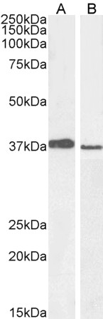 Goat Anti-MEL18 / PCGF2 Antibody