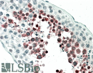 Goat Anti-MEPCE Antibody